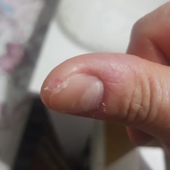 Arçelik Blenderin Rende Bıçağı Çıkmıyor Ve Kullanıcıya Zarar Veriyor