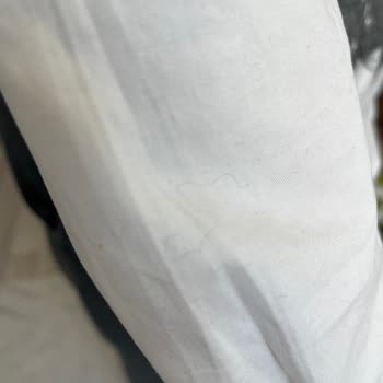 Twist Üründe Hızlı Tüylenme Ve Boyner’in Tekrarlayan Kopya Yapıştır İnceleme Yanıtı