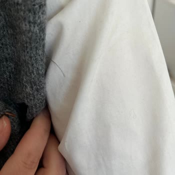 Twist Üründe Hızlı Tüylenme Ve Boyner’in Tekrarlayan Kopya Yapıştır İnceleme Yanıtı