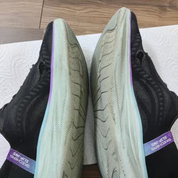 Skechers Ayakkabılarda Garanti İhlali Ve İade Talebi