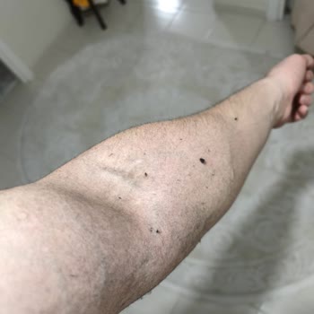 Ürün Tüylenmesi Ve İlgisiz Müşteri Hizmetleri