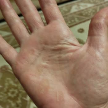 Neutrogena Hızlı Emilen Çok Amaçlı Krem Ve El Kremi Şikayeti