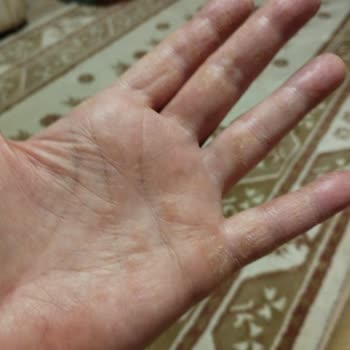 Neutrogena Hızlı Emilen Çok Amaçlı Krem Ve El Kremi Şikayeti