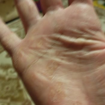 Neutrogena Hızlı Emilen Çok Amaçlı Krem Ve El Kremi Şikayeti