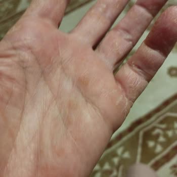 Neutrogena Hızlı Emilen Çok Amaçlı Krem Ve El Kremi Şikayeti