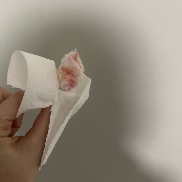 Koton Kabanında Kullanılmış Pamuk Bulunması Hijyen Şikayeti