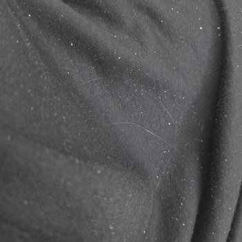 Yves Rocher Anti-Chute Şampuanı Şiddetli Kaşıntı Ve Kepek Nedeniyle İade Talebi