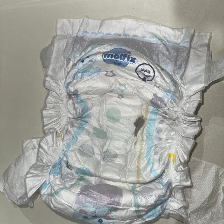 Molfix Bebek Bezinde Sert Siyah Yabancı Madde Güvenlik Endişesi Ve Değişim Talebi