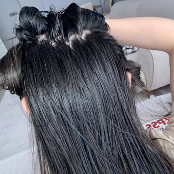 Saç Dökülmesi Karşıtı Şampuanın Yanma Ve Kaşınma Sorunu Eczane İnceleme Gecikmesi