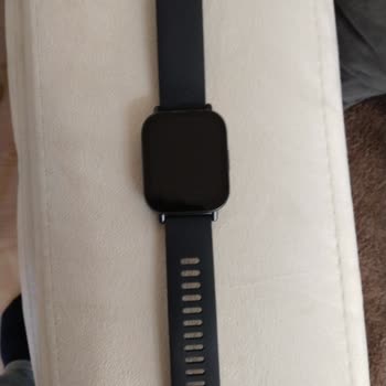 Redmi Watch 5 Active Şarj Kablosu Eksikliği İçin Ücretsiz Gönderim İsteği