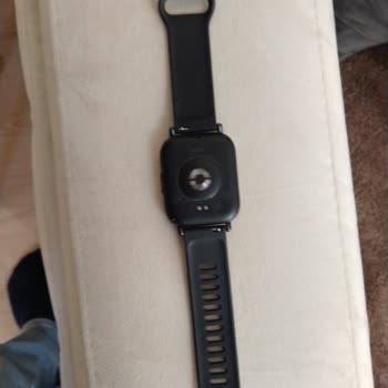 Redmi Watch 5 Active Şarj Kablosu Eksikliği İçin Ücretsiz Gönderim İsteği