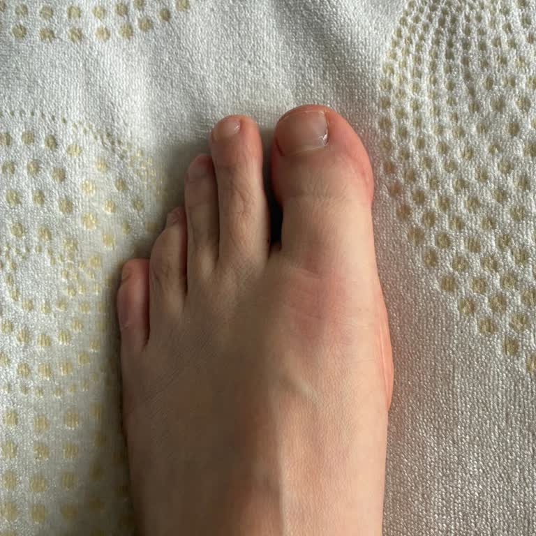 Sağlık Sorunu Yaratan Botta 21 Gün Bekleme Ve Geri Ödeme Talebi