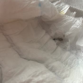 Molfix Bebek Bezinde Yabancı Madde Tespiti Ve Sağlık Endişesi