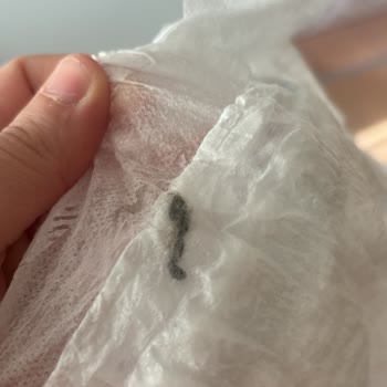 Molfix Bebek Bezinde Yabancı Madde Tespiti Ve Sağlık Endişesi