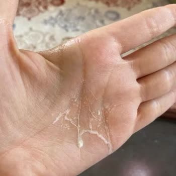 Sahte L'Loreal Paris Güneş Kremi Şikayet Ve İade Talebi