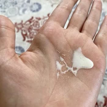 Sahte L'Loreal Paris Güneş Kremi Şikayet Ve İade Talebi