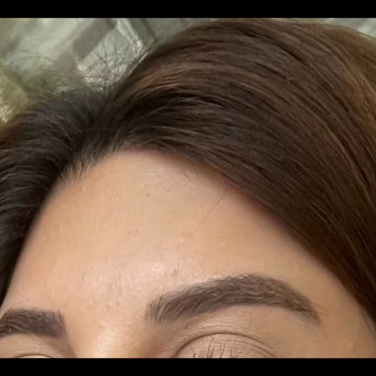 Bursa FSM E**** D****’da Microblading Süre Ve Renk Bilgilerindeki Çelişkili Açıklamalar