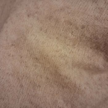 İlk Yıkamada Tüylenen Ürün İçin Değişim Ve İade Talebi