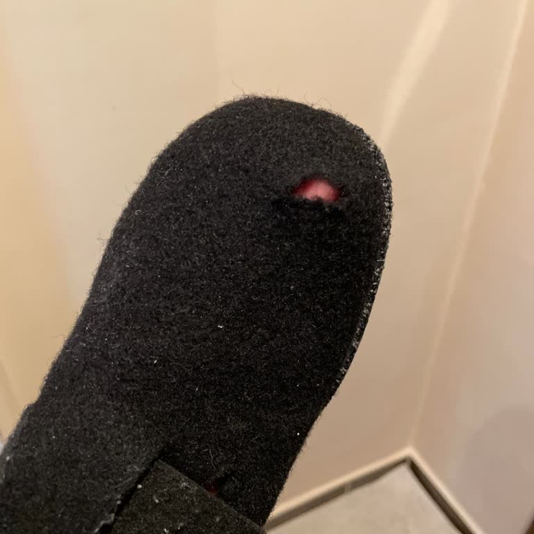 Kifidis Terliğinde Hızlı Yırtılma Ve Değişim Reddi