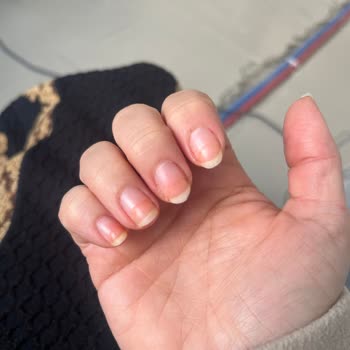 Flormar Jelly Look Ojesi Tırnak Sararmasına Neden Oldu