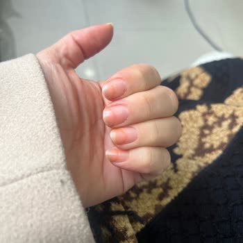 Flormar Jelly Look Ojesi Tırnak Sararmasına Neden Oldu