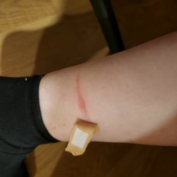 Botların Deriyi Kesmesi Ve Güvenlik Sorunu