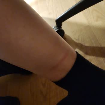 Botların Deriyi Kesmesi Ve Güvenlik Sorunu