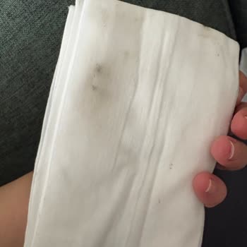 Küflü Bebek Mendili Sleepy Bionatural Ürününde Sağlık Tehlikesi