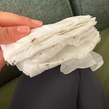 Küflü Bebek Mendili Sleepy Bionatural Ürününde Sağlık Tehlikesi