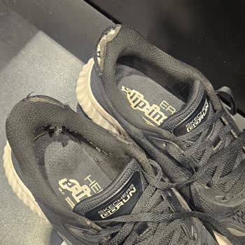 Üç Ayda Paramparça Olan Skechers Ayakkabısının Üretim Kusuru Reddi