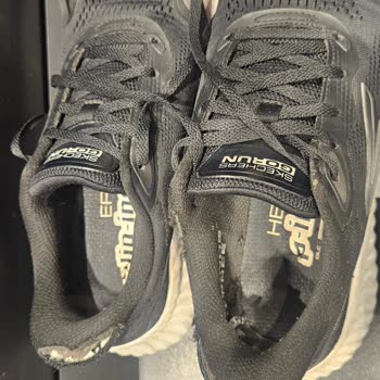 Üç Ayda Paramparça Olan Skechers Ayakkabısının Üretim Kusuru Reddi