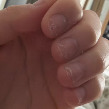 Buse Özdemir Beauty Tırnaklarım İnanılmaz Kötü Durumdaydı