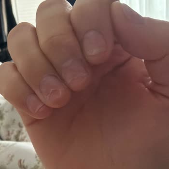 Buse Özdemir Beauty Tırnaklarım İnanılmaz Kötü Durumdaydı