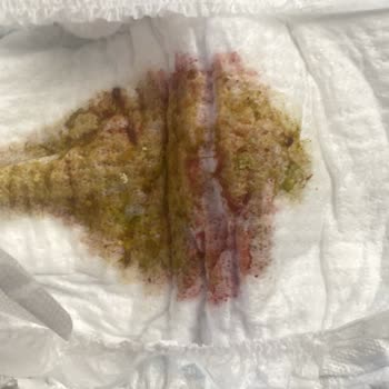 Bebekte Bağırsak Kurtlanması: Organik Pirinç Unu Ve İrmik Seti Şikayeti