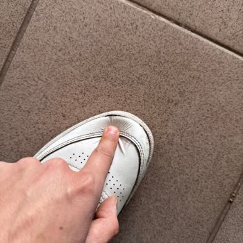 Reebok Ayakkabısında Altı Ay İçinde Deri Dökülmesi Ve Garanti Reddi