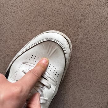 Reebok Ayakkabısında Altı Ay İçinde Deri Dökülmesi Ve Garanti Reddi