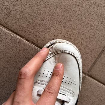 Reebok Ayakkabısında Altı Ay İçinde Deri Dökülmesi Ve Garanti Reddi