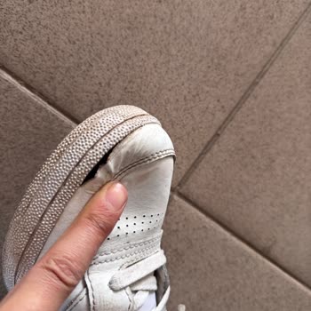 Reebok Ayakkabısında Altı Ay İçinde Deri Dökülmesi Ve Garanti Reddi