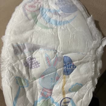 Molfix Bebek Bezlerinde Hatalı Bant Ve Sızıntı Sorunu Değişim Talebi