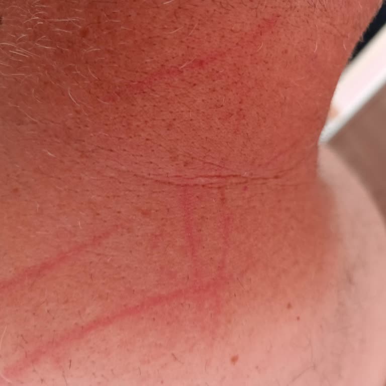 Rossmann Tıraş Makinesi Cildi Tahriş Ediyor Ve Saç Kesiminde Sorun Yaşıyor