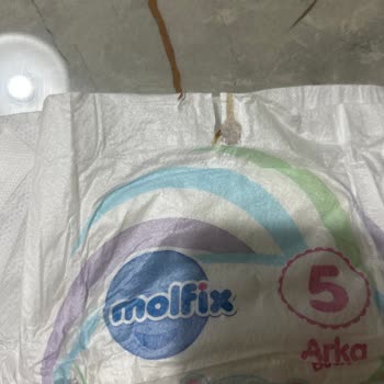 Molfix Bebek Bezinde Yabancı Madde: Güvenlik Endişesi Ve İade Talebi