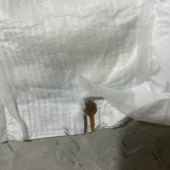 Molfix Bebek Bezinde Yabancı Madde: Güvenlik Endişesi Ve İade Talebi