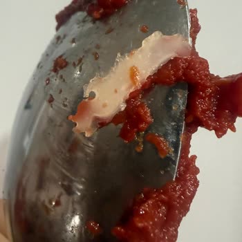 Tat Kavanoz Üründe Yabancı Cisim Ve Hijyen Sorunu