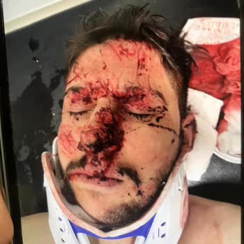 Quick Sigorta’nın Tazminat Ödemesini Geciktirmesi Mağduriyet Yaratıyor