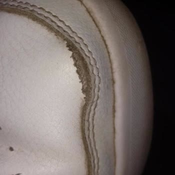 Ayakkabının Hızlı Deformasyonu Ve Boyner'in Üretim Hatası İddiasını Reddetmesi