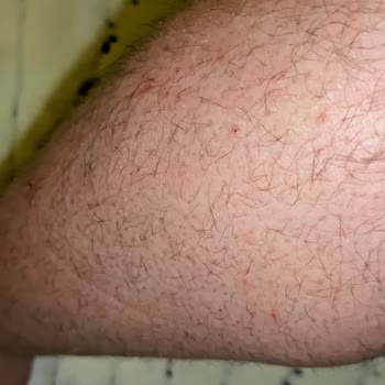 Palmolive Duş Jelinde Şiddetli Kaşıntı Ve Yetersiz Çözüm