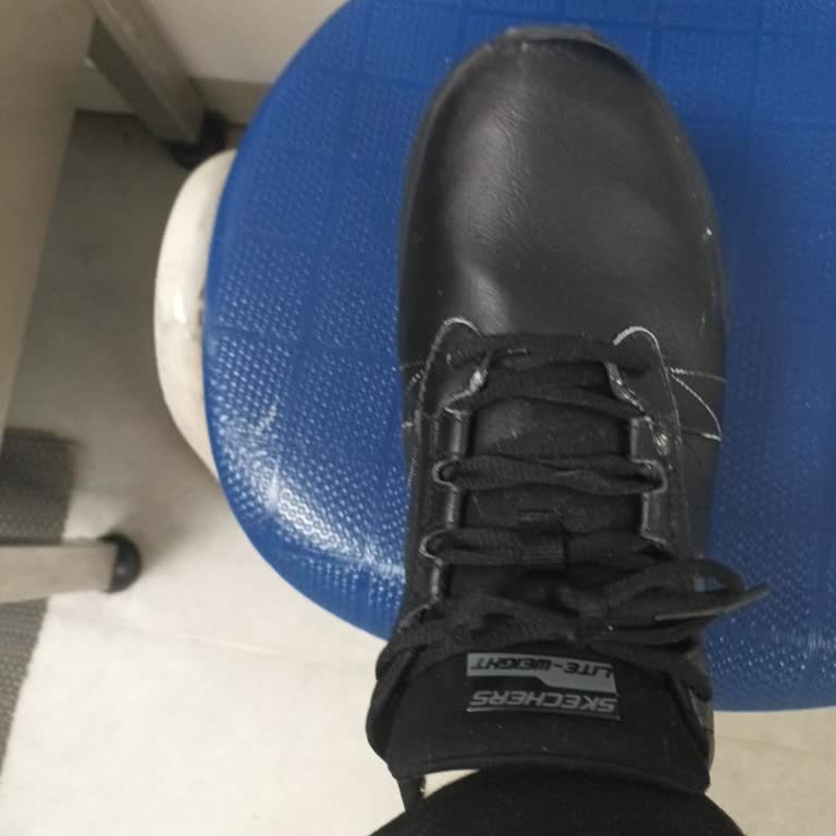 Skechers Deri Ayakkabıda Dikiş Beyazlaması Ve Red Cevabı