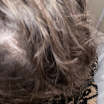 Olcay Yılmaz Adana Kuaför Saçlarım Bir Anda Kül Olmuş Gibi Paramparça Hale Geldi