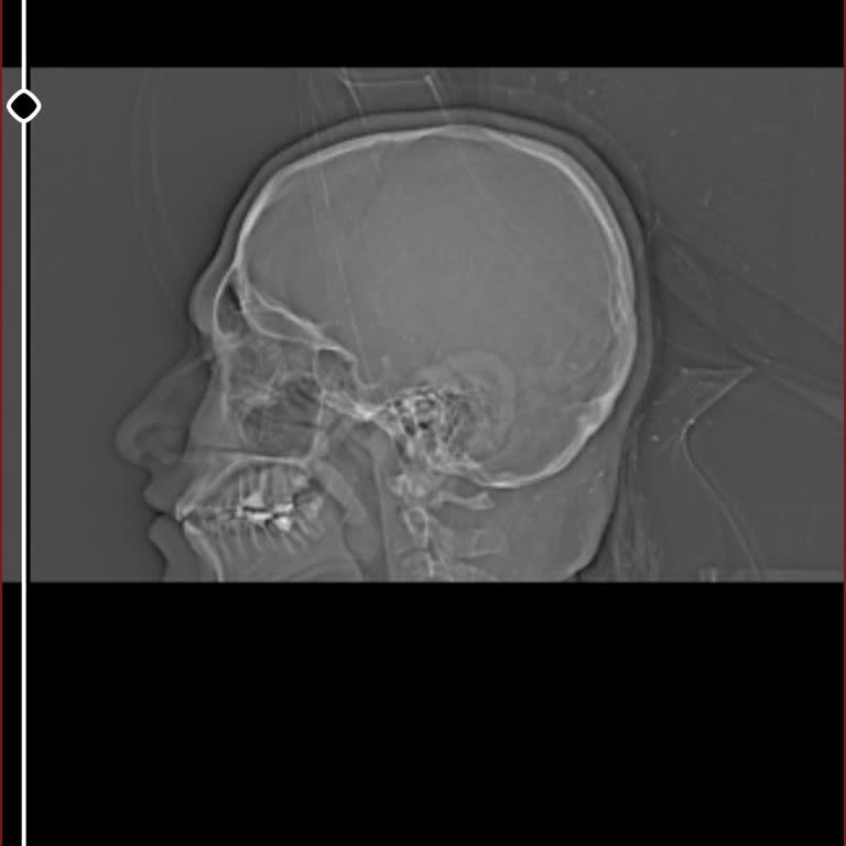 Gemlik Devlet Hastanesinde Beyin Cerrahisi Doktorunun Hastaları Dinlemeyip Yönlendirmesi