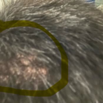 B&B Protez Saç Merkezi Kalitesiz Protez Saç Ve Ölçü Renk Hatası, Saygısız Müşteri Hizmeti